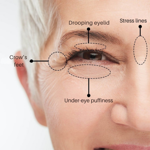 Samaya Instant Eye Lift Cream™